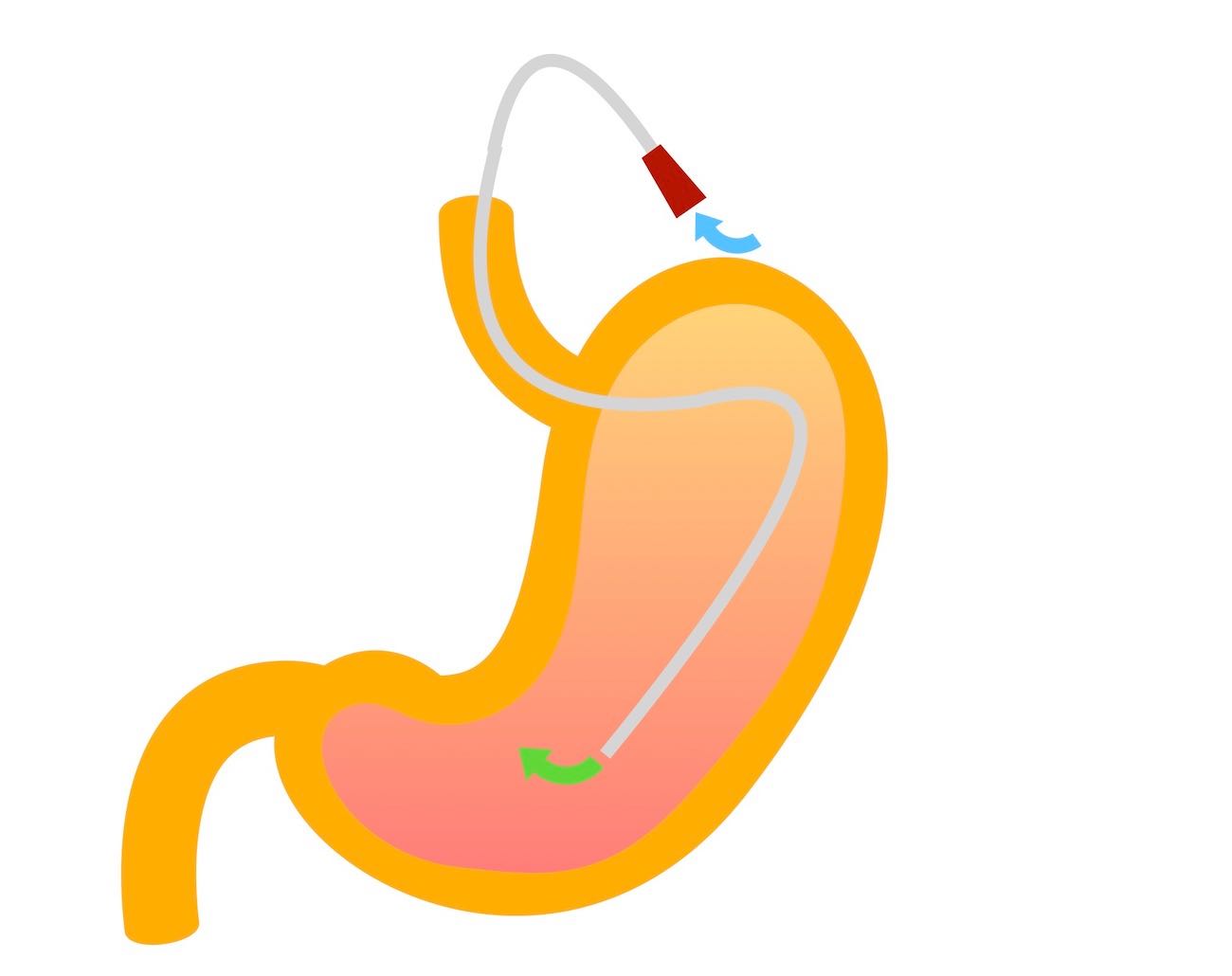 Wellington ICU Drug Manual - Administration of Medicines via Enteral Feeding Tubes